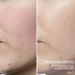 Babor SOS Calming Ampoule Concentrates 14 ml
