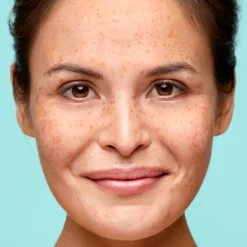 Biodermal Dagcrème Gevoelige Huid 50 ml