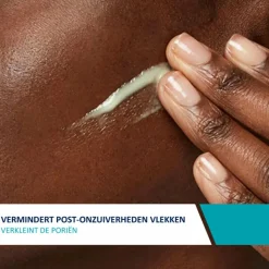 CeraVe Resurfacing Retinol Serum 30 ml