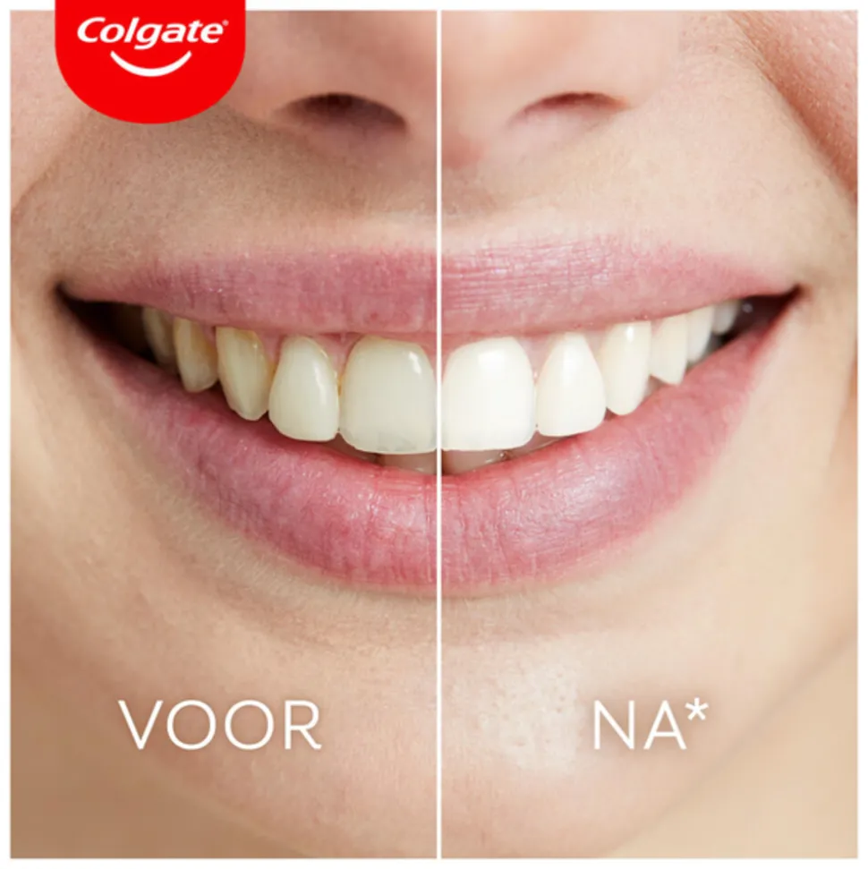 Colgate Max White Ultimate Led Whitening Kit 1 set