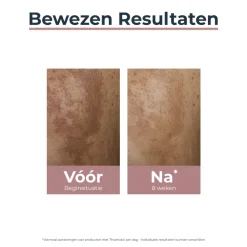 Eucerin Anti-Pigment Spot Corrector 5 ml