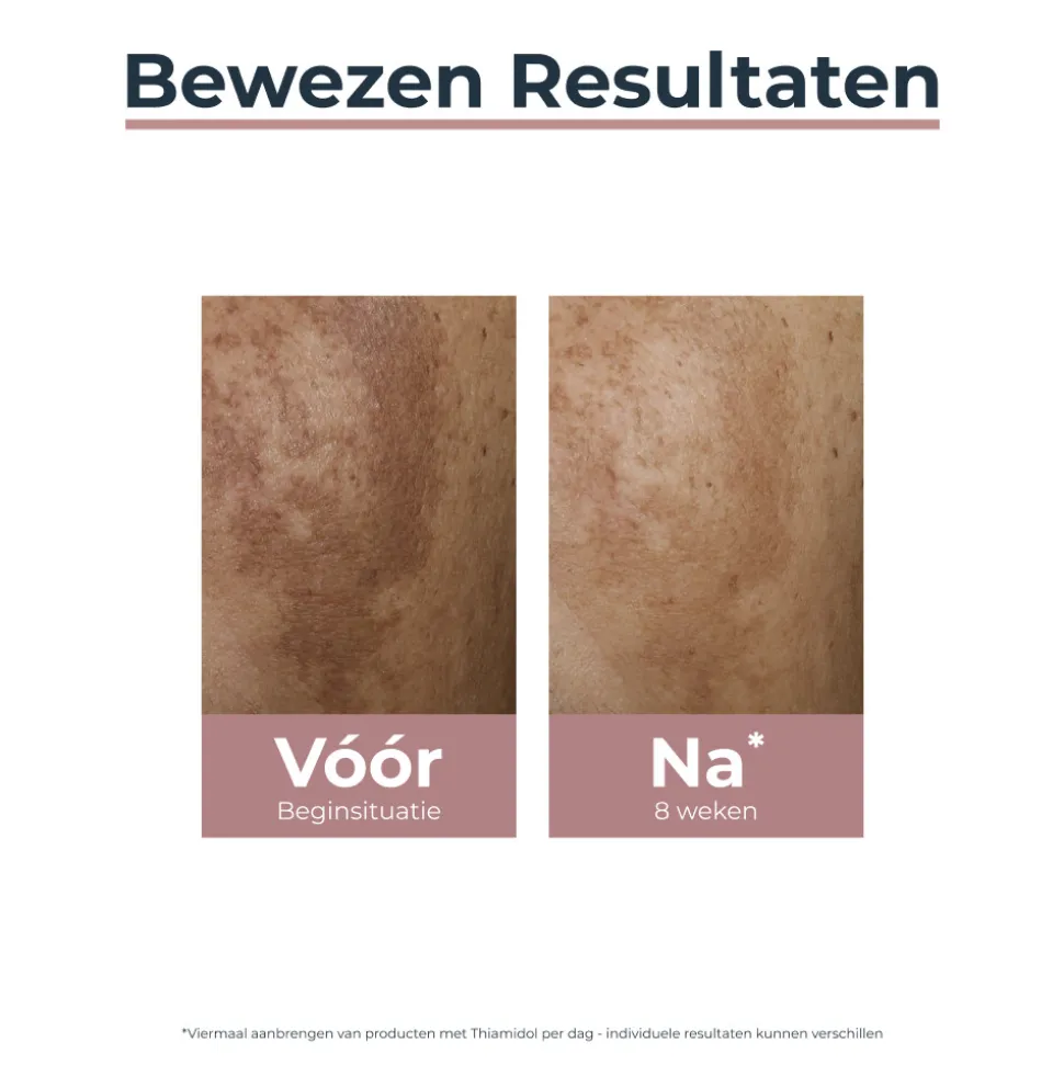 Eucerin Anti-Pigment Spot Corrector 5 ml