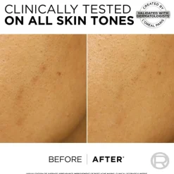 L'Oréal Dark Spot Exfoliant Snakepeel Bright Reveal 25 ml