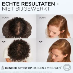 L'Oréal Elvive Fiber Booster Anti-Haaruitval Shampoo 200 ml