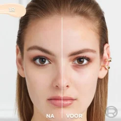 L'Oréal True Match Radiant Serum Concealer 1R 11 ml