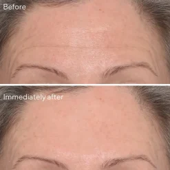 Murad Skincare Resurgence Targeted Wrinkle Corrector 15 ml