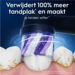 Oral-B Opzetborstels iO Radiant White Zwart 4 stuks
