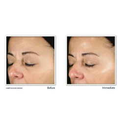 RoC Multi Correxion Revive + Glow Daily Serum 30 ml