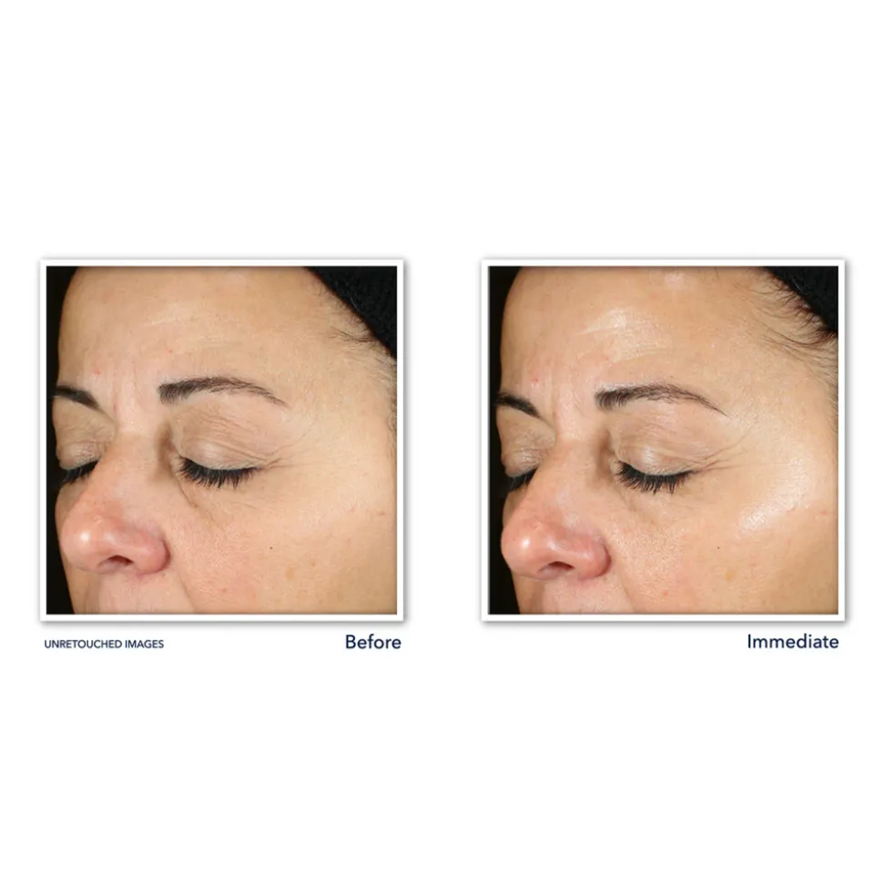 RoC Multi Correxion Revive + Glow Daily Serum 30 ml