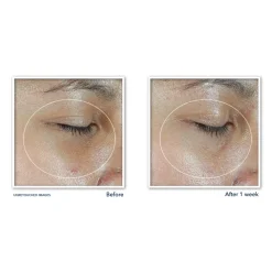 RoC Multi Correxion Revive + Glow Eye Stick 4 gr