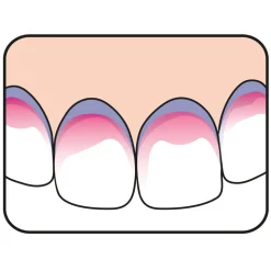 TePe PlaqSearch 10 tabletten