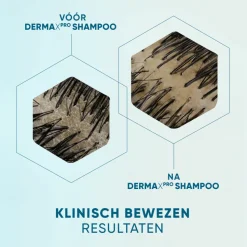 6x Head & Shoulders Anti-roos Shampoo DERMAxPRO Kalmeert 250 ml
