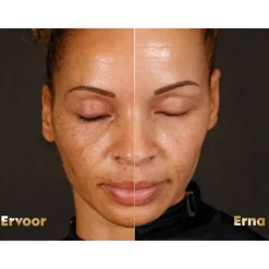 3x NIVEA Luminous 630 Dagcrème Anti-Spot SPF 50 40 ml