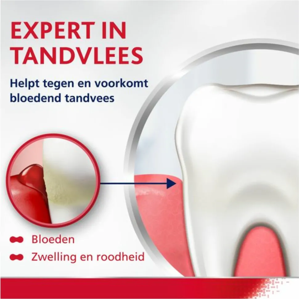 6x Parodontax Complete Protection Extra Fresh tegen Bloeden Tandvlees 75 ml