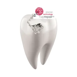 6x Vitis Mondwater Whitening 500 ml